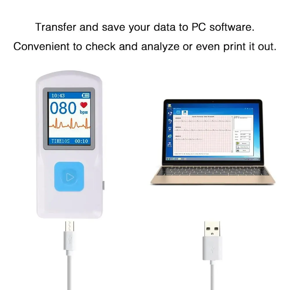 Портативный Bluetooth ЭКГ-аппарат PM10 USB Перезаряжаемый монитор ЭКГ портативный