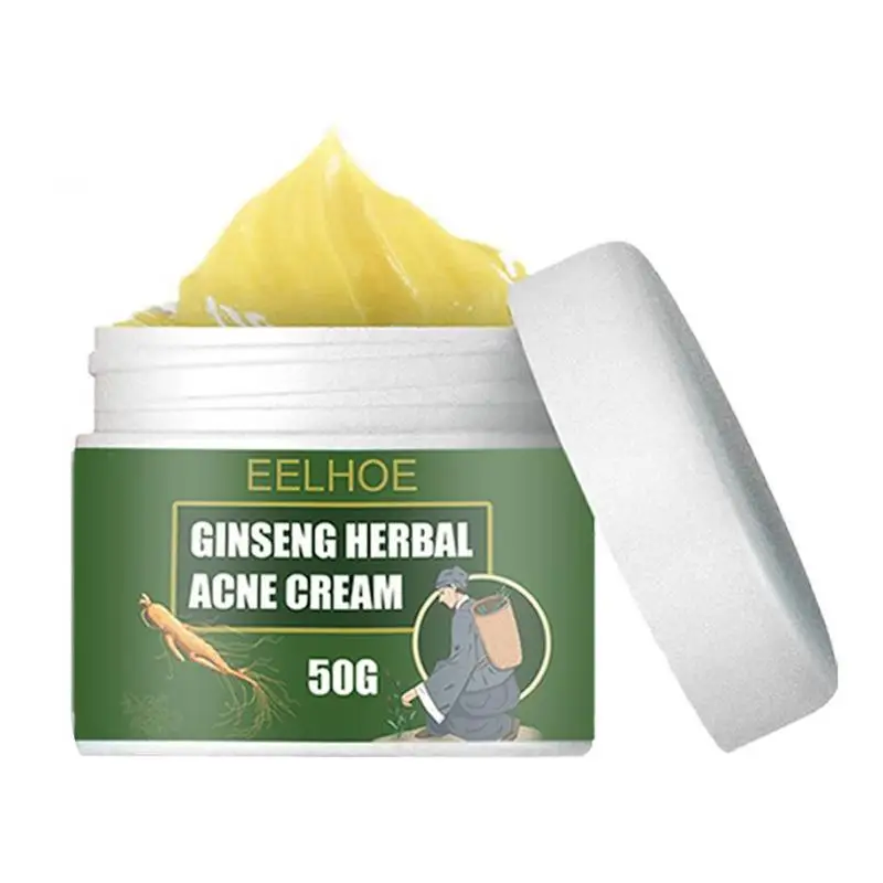 

Pimple Face Cream Aloe Spot Cream For Clearing Severe Spots Scar Cream Spot Balance Water And Oil Perfect For Spots Scar Removal