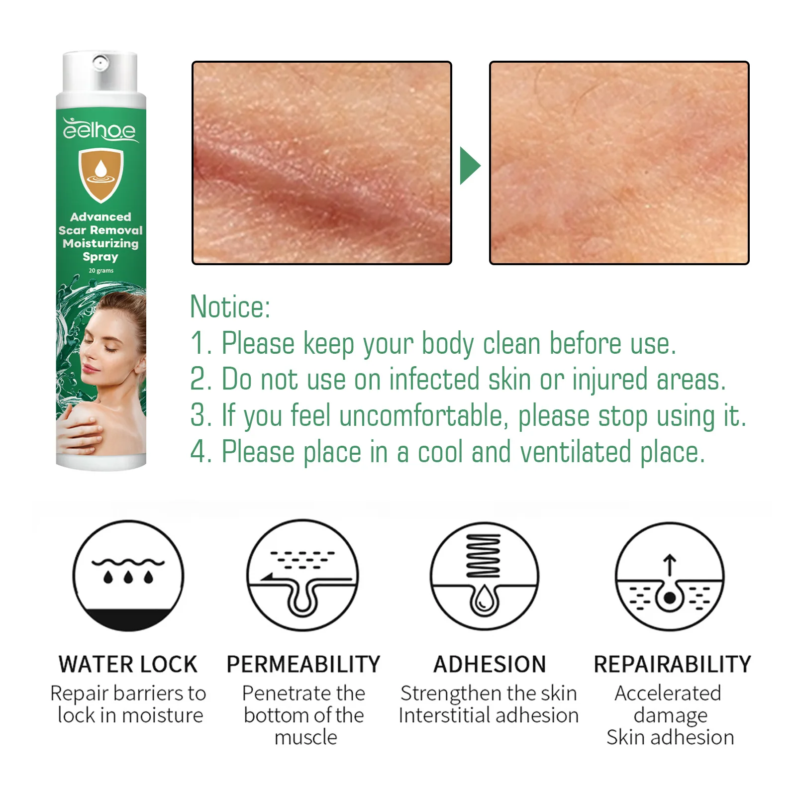 Рисунок 6 - Крем для удаления шрамов спрей