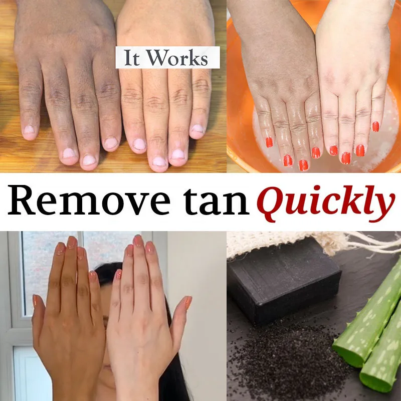 

Черный кирпич, Зимний уход за кожей, витамин С, удаляет загар с рук, осветляет кожу, уменьшает выцветание, пигментацию, пигментацию, меланино...