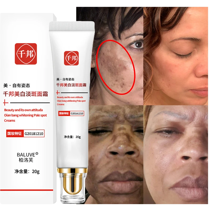 

Effective Whitening Freckle Cream Remove Melasma Dark Spots Lighten Pigment Brighten Melanin Correcting Beauty Face Skin Care