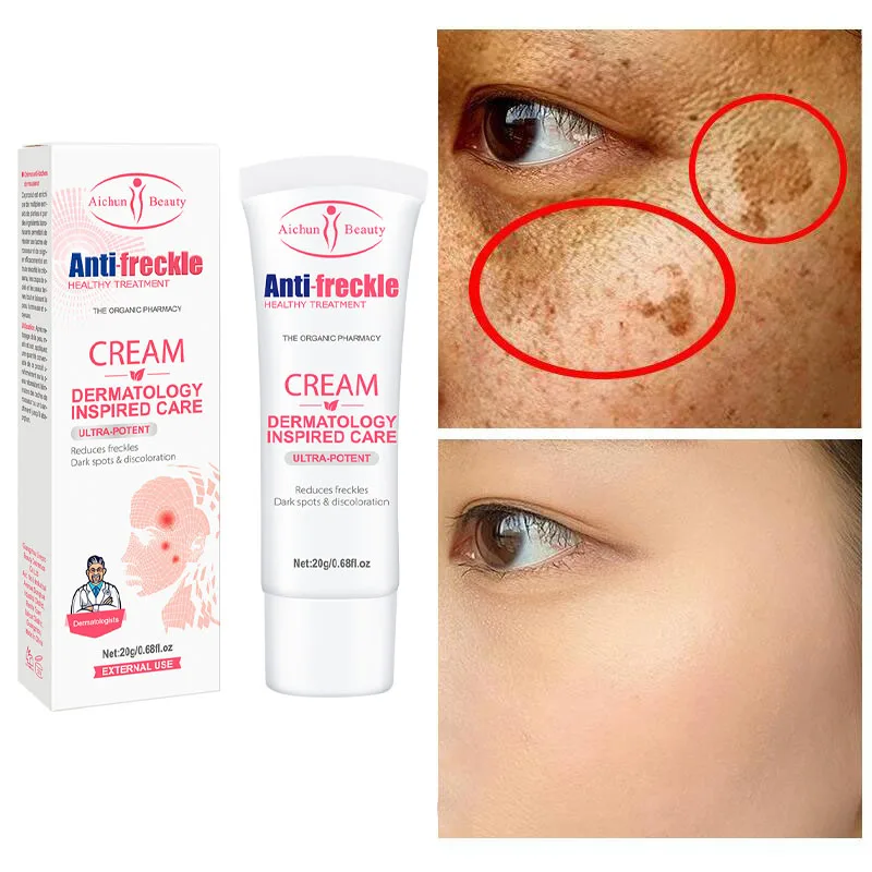 

Cream Whitening Freckle Removal Cream Remove Dark Spots Melanin Melasma Pigmentation Anti-Aging Brighten Face Skin Care Cosmetic