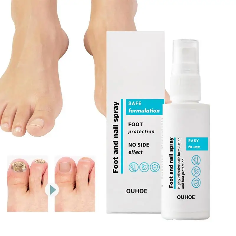 

Women's Toenail Care Spray Daily Moisturizing Repair Moisturizer Heels Care Mist Gentle Soothing Odor Remove Foot Spray For