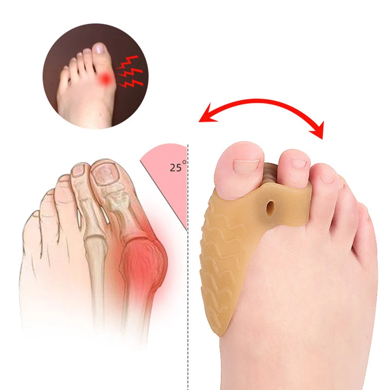 

Выпрямитель для большого пальца ноги, защита от вальгусной деформации большого пальца, силиконовые подушечки для ног, облегчение боли в ступнях