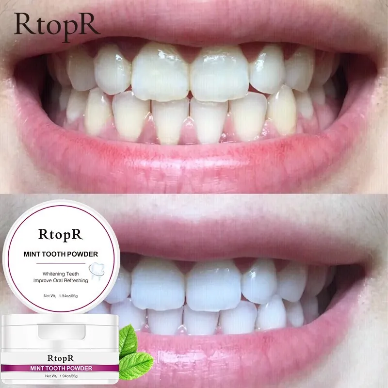 Отбеливание зубов стоматология отбеливание чистящий порошок натуральный жемчуг