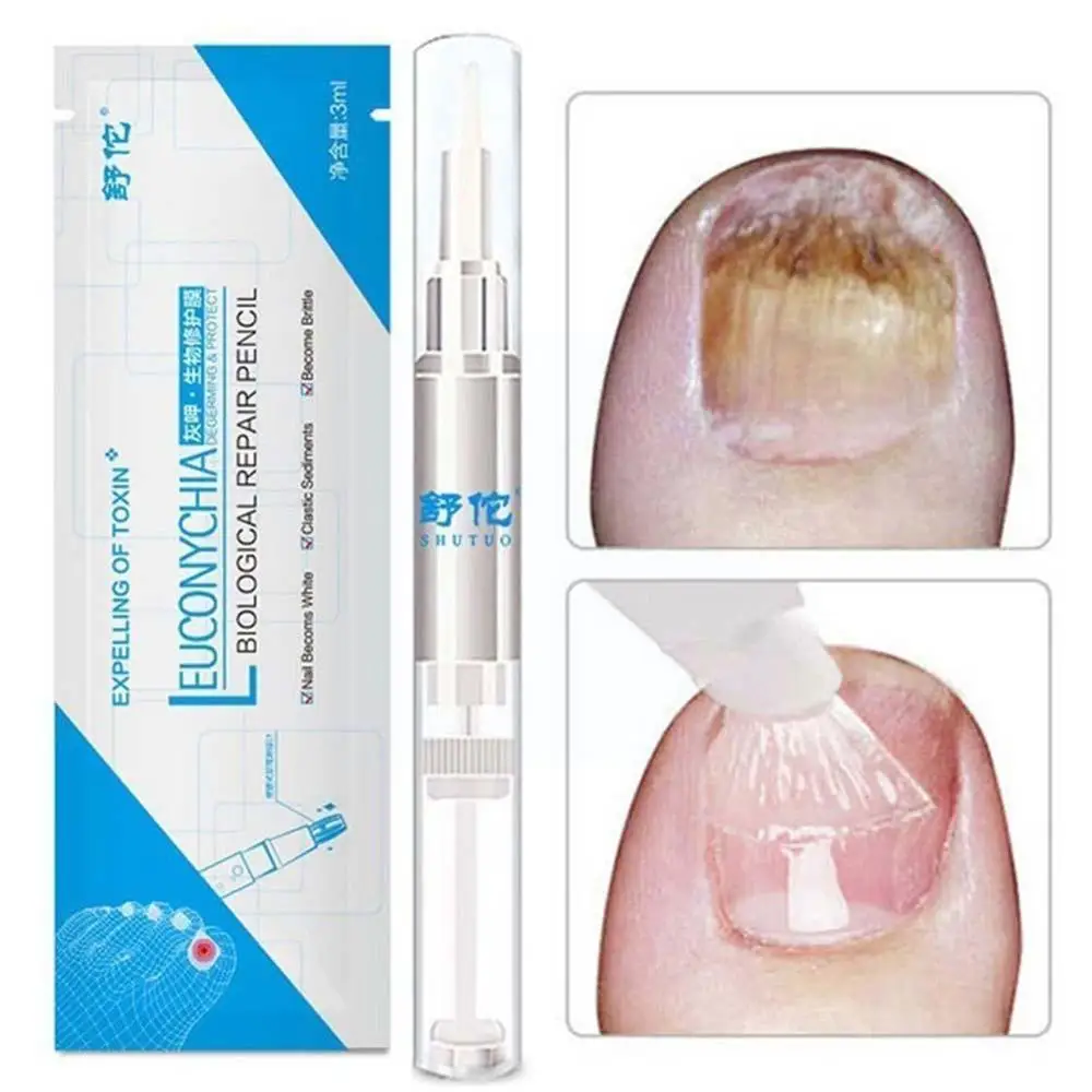 

1pc Nail Fungal Treatment Pen Anti Fungus Infection Restores 3ml Biological Repair Oil Solution Toenails Healthy Nutritious X1S8