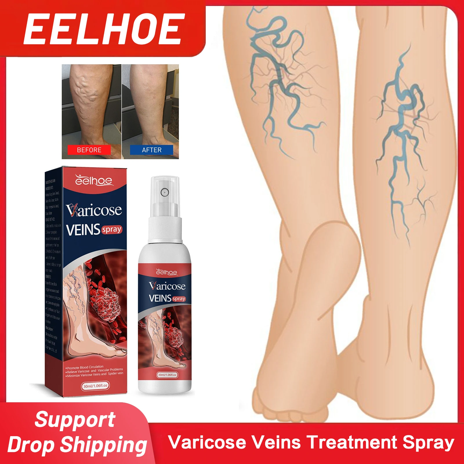 

Varicose Veins Treatment Spray Earthworm Legs Cure Sooth Leg Redness Swollen Improve Blood Circulation Spider Pain Relief Spray