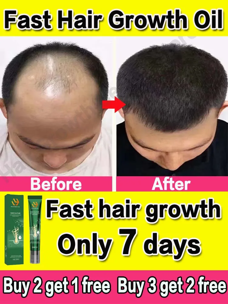 

Hair growth oil fast anti hair loss man woman products