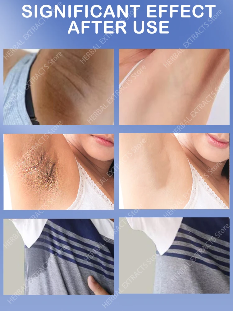 

Armpit Odor Remover Woman For Strong Sweat Body Odor Anti Sweating Deodorant For Men Antiperspirant Long Lasting Underarm