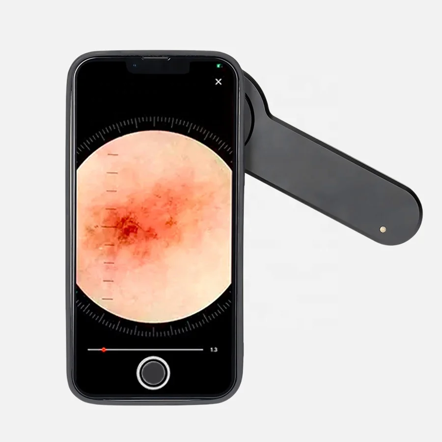 IBOOLO Medical Dermascopy DE-3100 PRO Портативный поляризованный дерматоскоп УФ-устройство для