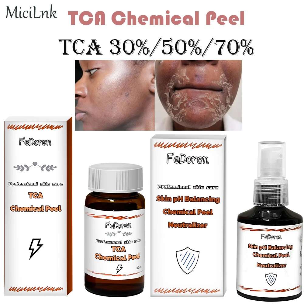 

30ml TCA Chemical Peel 70% Tca Peel Acid Peeling Acid neutralizer set skin Superforce Peeling Pigmentation Acne Scar Brighten