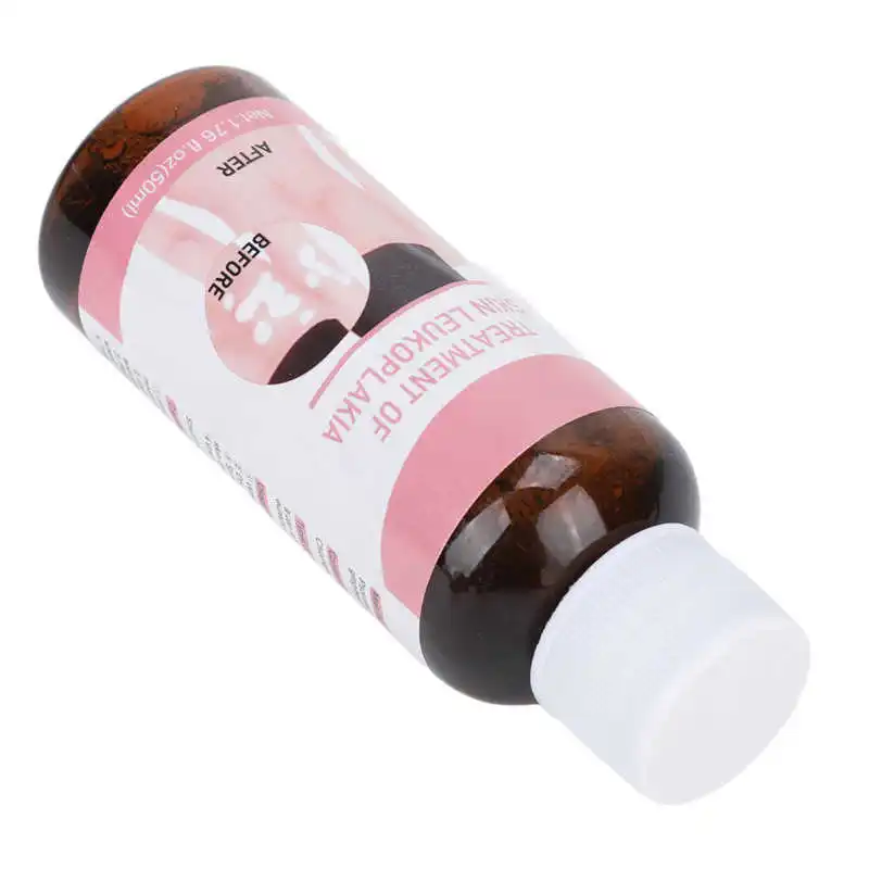 

Vitiligo Spray Herbal Vitiligo Treatment Serum for Home Travel