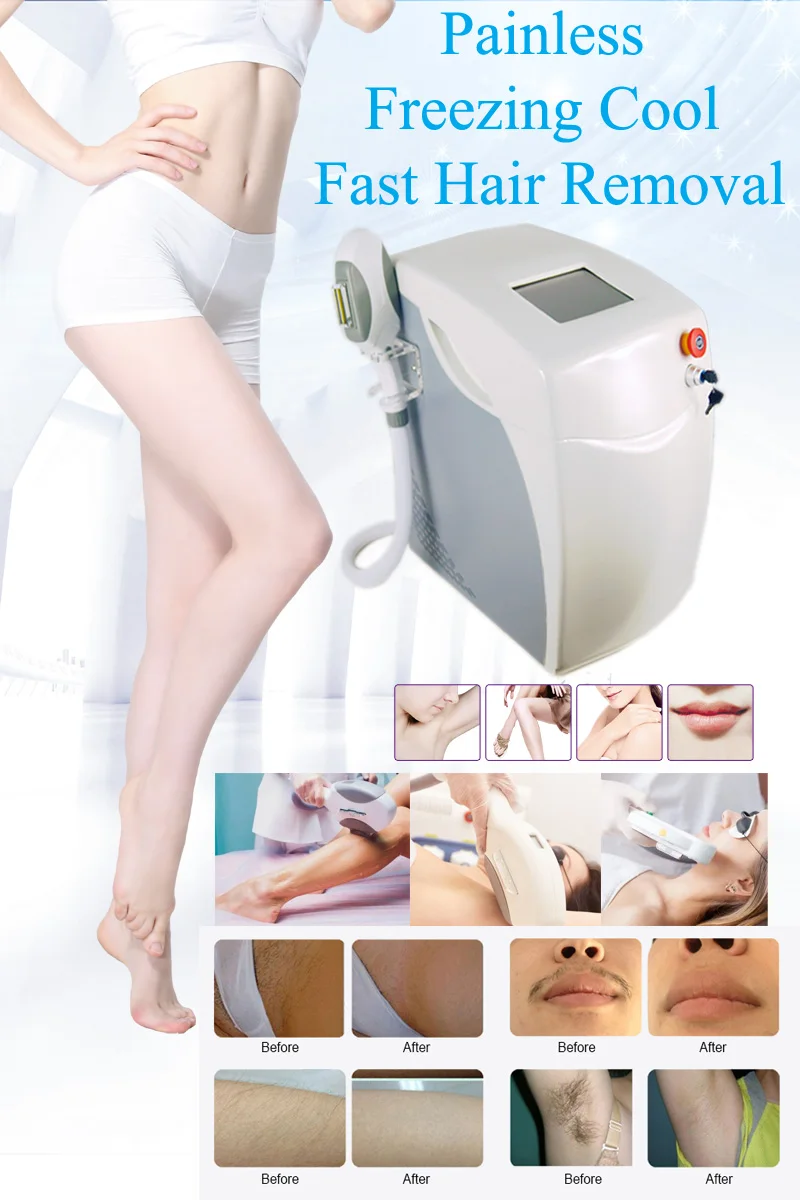 AU-S200B Auro для домашнего использования E-светильник OPT SHRr IPL RF устройство удаления