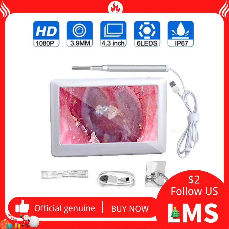 

3.9mm Otoscope with 1080P 4.3 Inch Screen 6 LED Lights Visual Ear Endoscopic Camera Ear Pick Oral Inspection