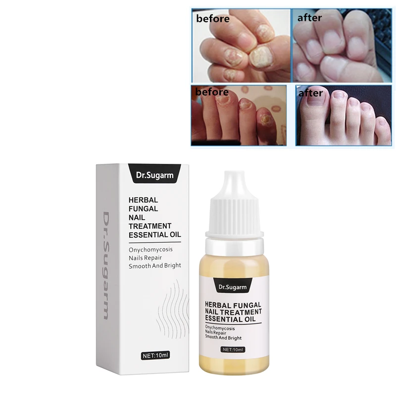 

Dr.Sugarm Fungal Nail Treatment Foot Care Essence Whitening Toe Fungus Anti Infection Paronychia Onychomycosis Nail Growth