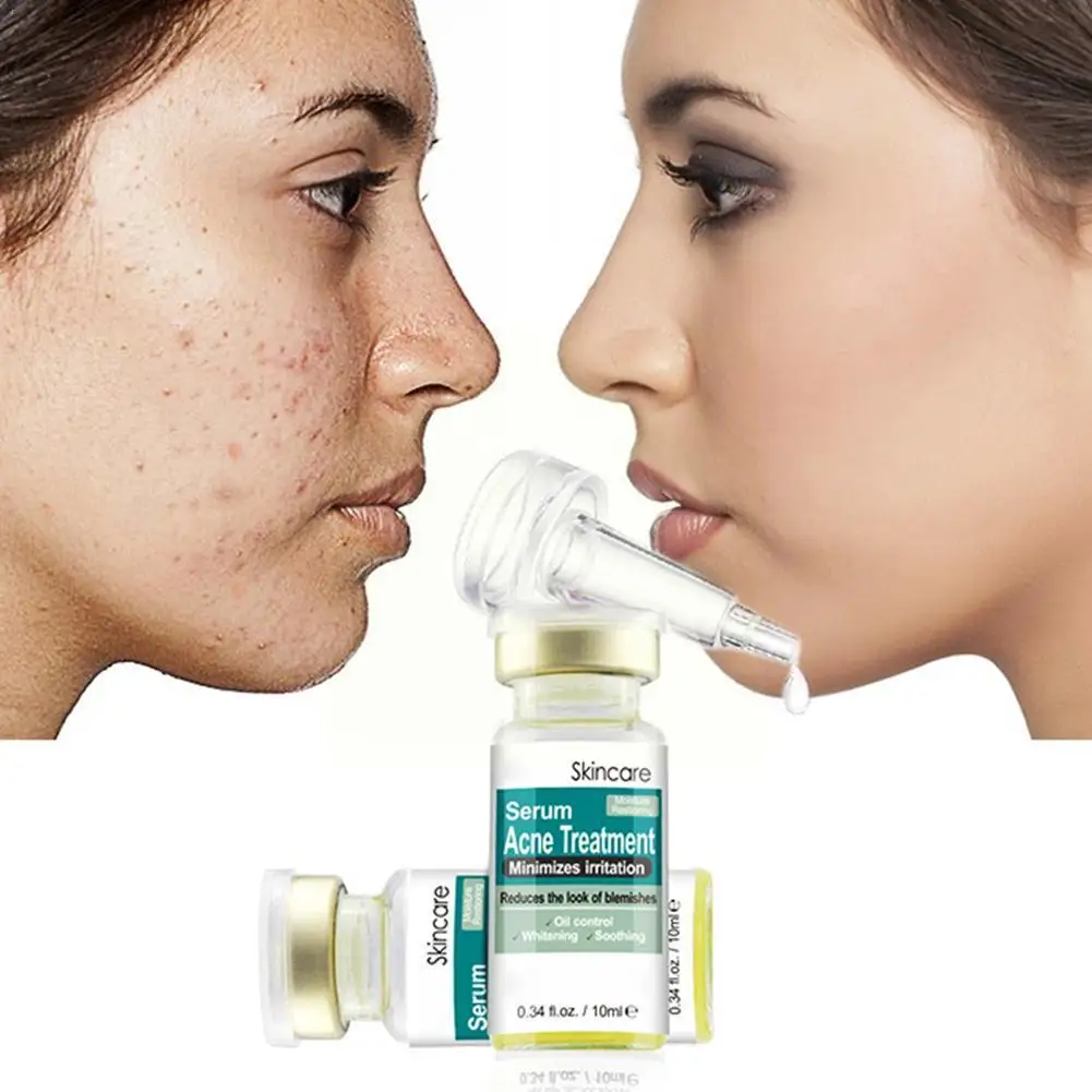 

Acne Treatment Serum Face Care Cream Oil-control Acne Care Scar Best Skin Face And Removal Make Whitening M1I6