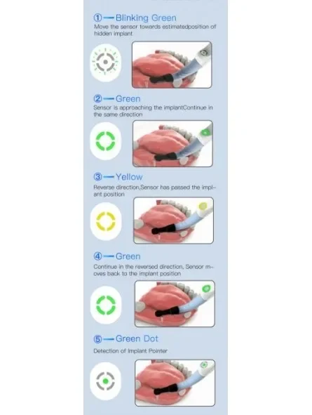 Детектор зубных имплантатов EasyinSmile EASYDO-DETECTOR 3-мерный локатор имплантатов с вращающейся на 270 градусов сенсорной головкой (art.: 3920d3a99eded) - 3920d3a99eded