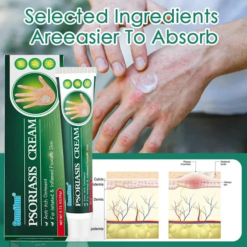 Крем от псориаза и экземы антибактериальный крем зуда