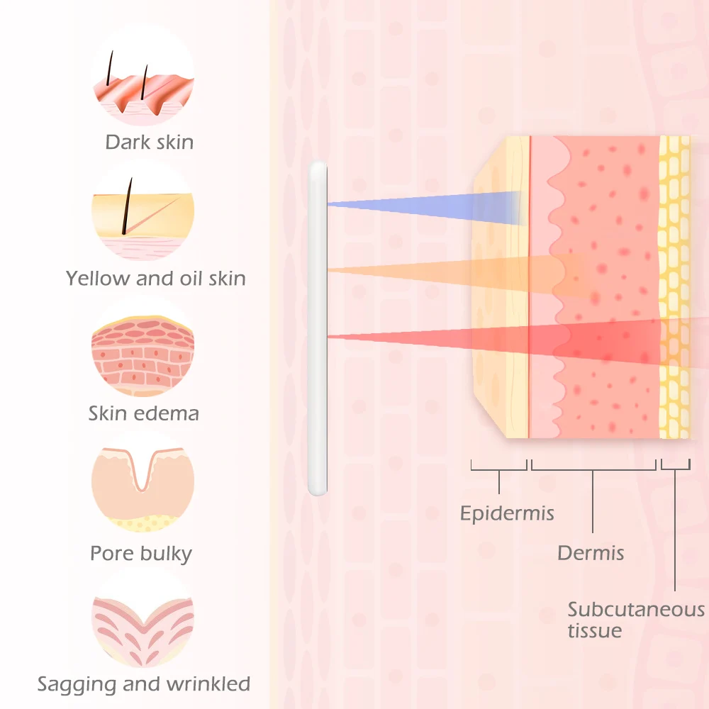 Аппарат для терапии со светодиодсветильник кой 7 цветов | Красота и здоровье
