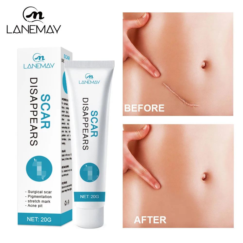 

Herbal Scar Removal Cream Stretch Marks Treatment Burn Acne Surgical Scar Repair Gel Smoothing Whitening Beauty Health Skin Care