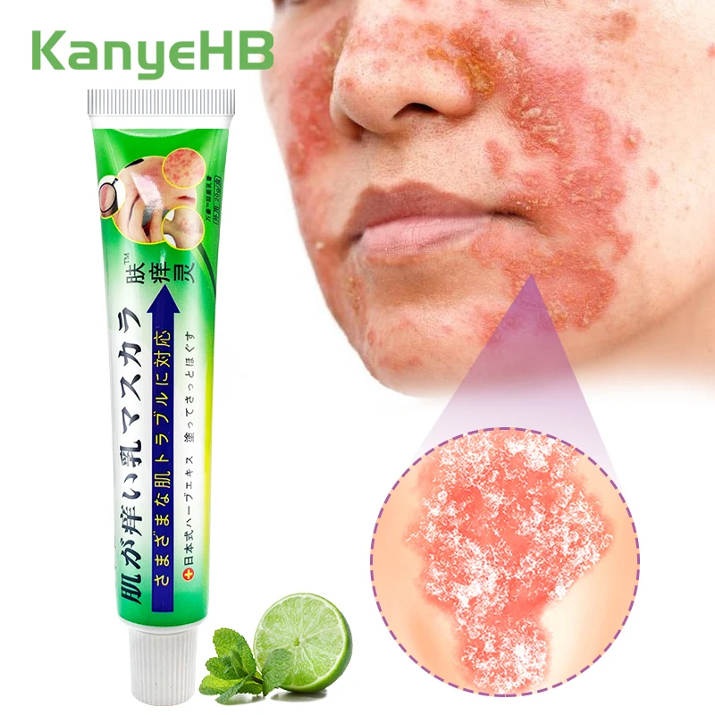 

1Pcs Psoriasis Cream Antibacterial Against Eczema Dermatitis Red Rash Chinese Herbal Medicine Skin Care Ointment Anti-Itch S111