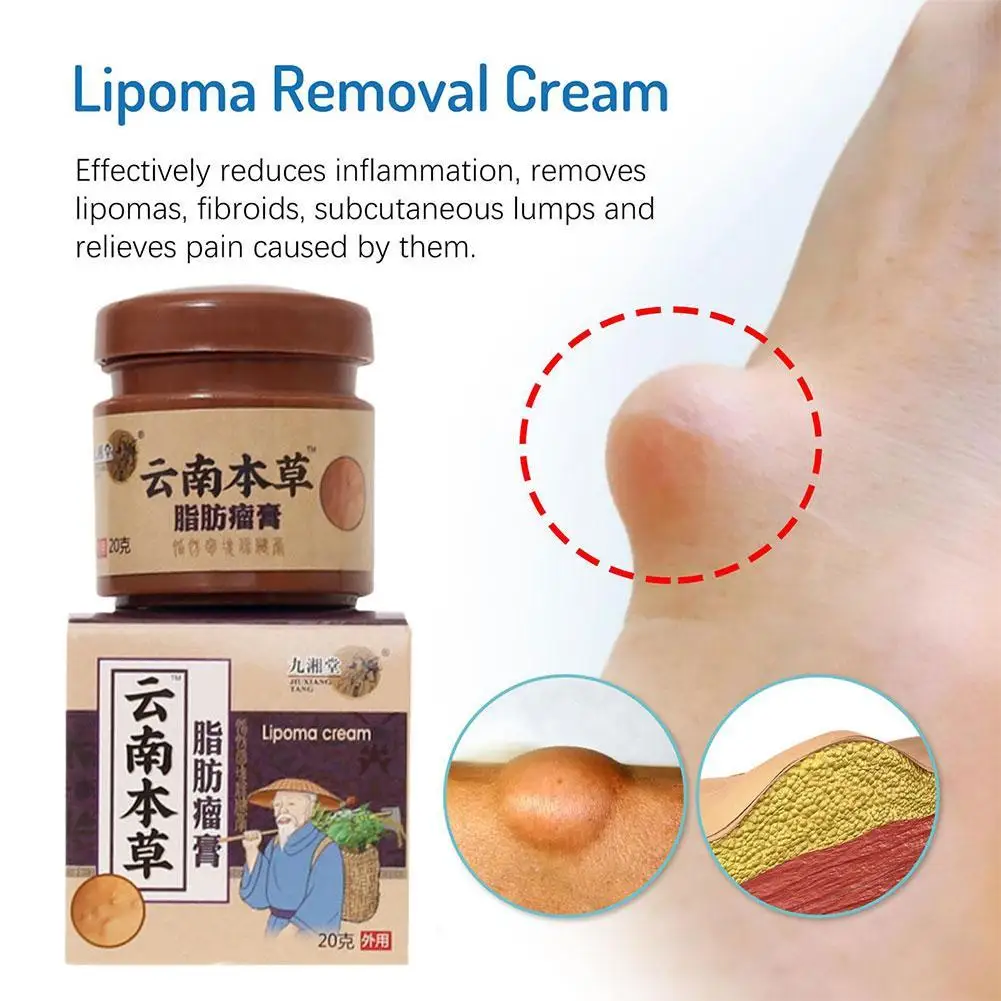 

Крем Lipoma, средство для удаления ложек под кожу, лечение, жидкость для лечения, набухание кожи, целлюлитный Fibroma, пластырь для массы жира