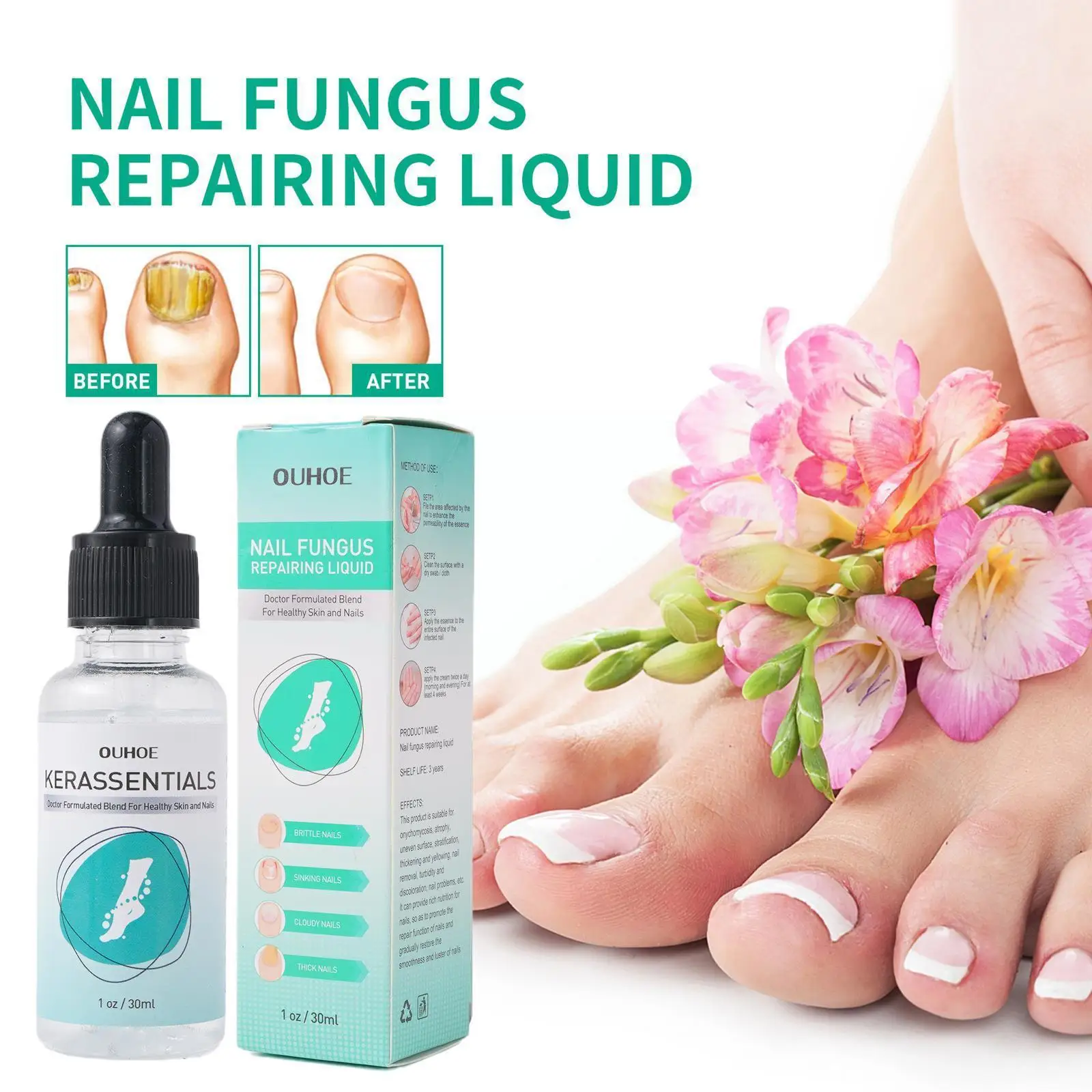 

Nail Fungus Treatment Essence Serum Care Hand Foot Care Repair Removal Anti-infective Anti Feet Gel Infection Onychomycosis Y6J3