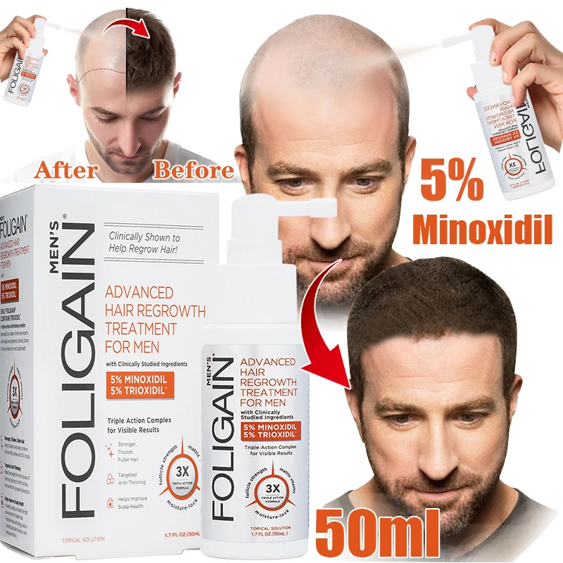 

Fast treatment anti hair loss products prevent hair thinning and drying nourish scalp hair follicles healthy hair care