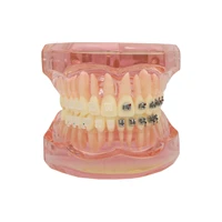dental teeth study demonstration orthodontic model with metal and ceramic brackets 3003 pink
