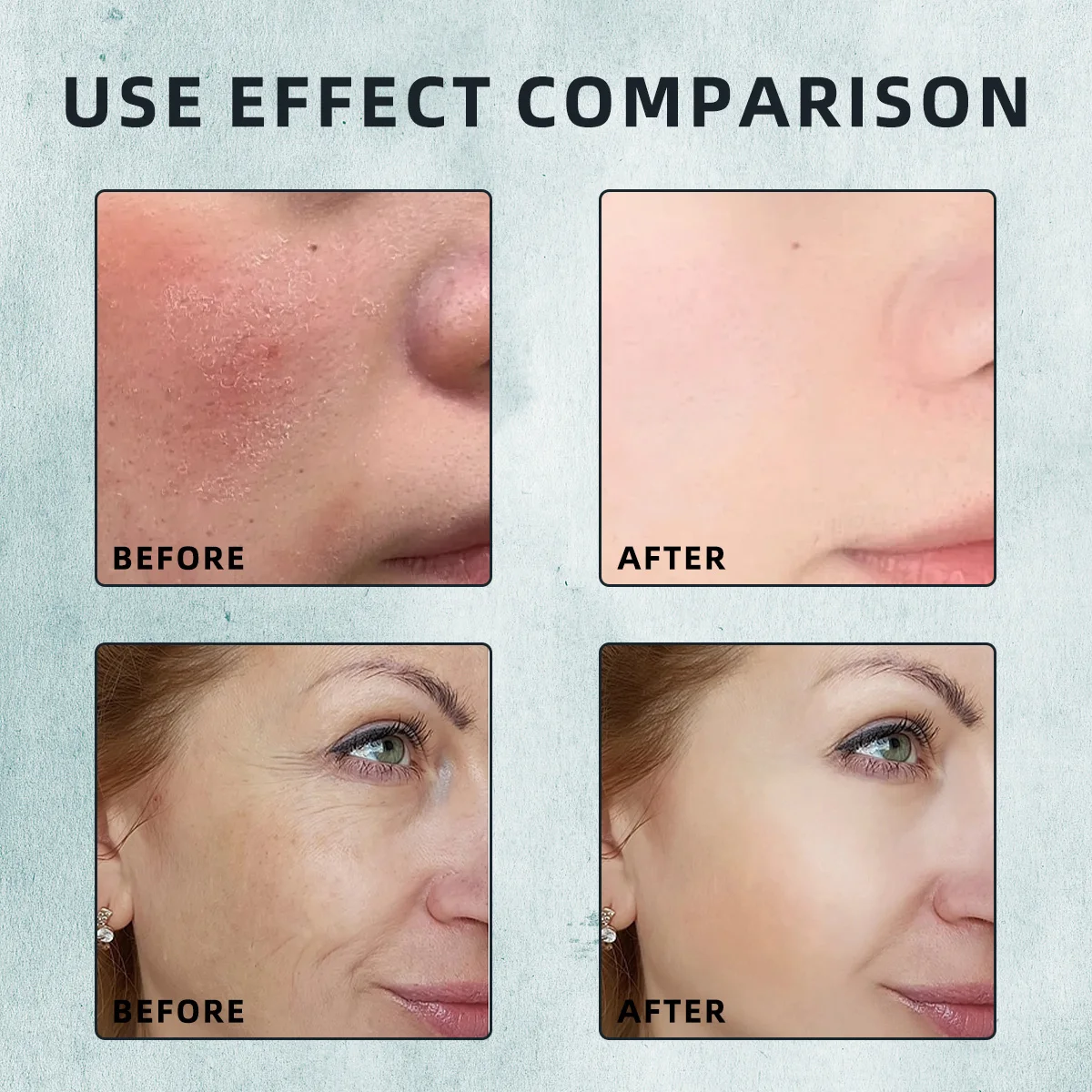 Фото Сыворотка с медным пептидом против старения, тонких линий, возрастных пятен, поврежденный коллаген, гиалуроновая кислота Ghk-cu, медная пептидная сыворотка для кожи лица №5