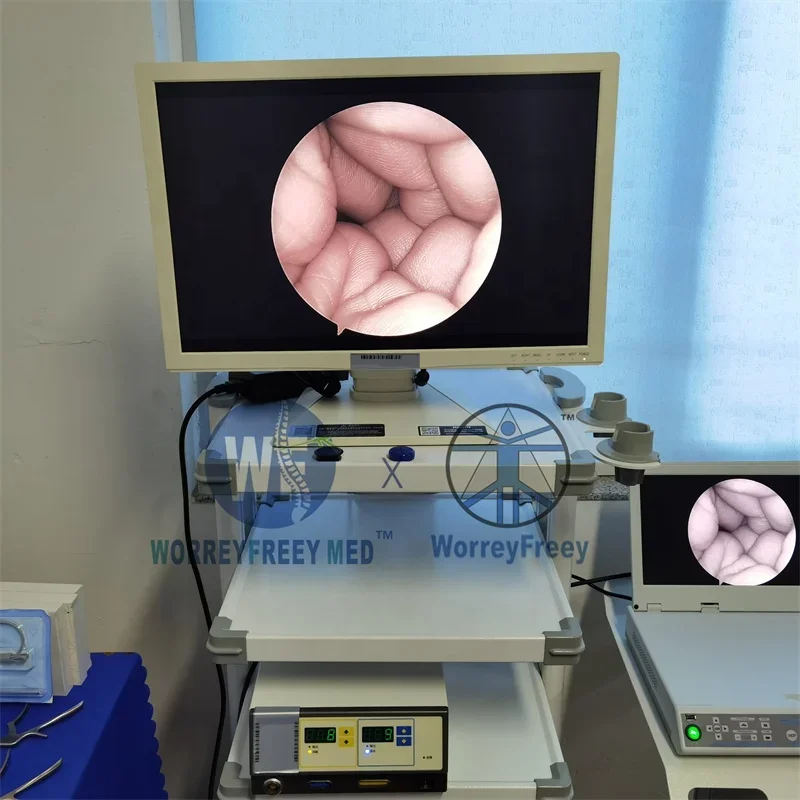 HD переносная эндоскоп-камера медицинский эндоскоп позвоночника Discectomy Interlaminar