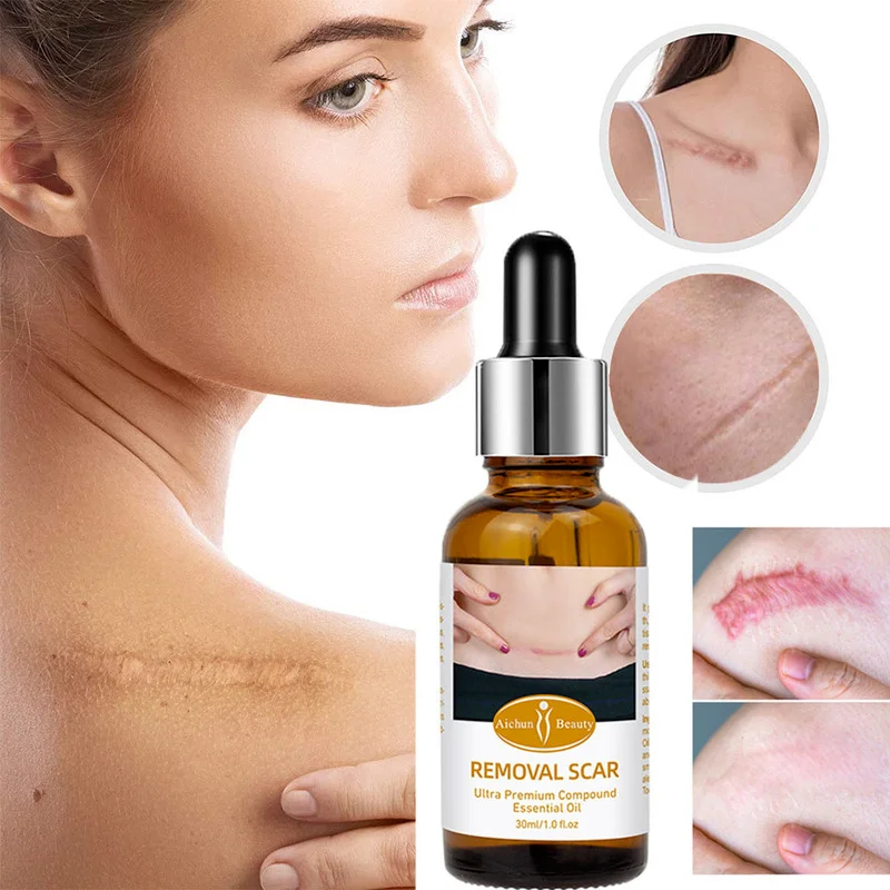 

Acne Scar Removal Oil Pimples Stretch Marks Remove Acne Smoothing Whitening Body Skin Care Pigmentation Corrector Skin Care