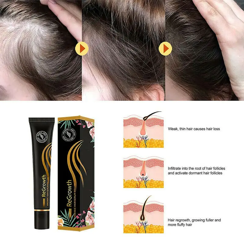 

Organic Hair Natural Serum Roller Set Rolling Ball Massage Anti-Fall Liquid Improve Hair Loss Treatment Hair Growth Oil