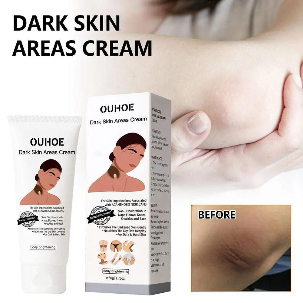 

Крем для удаления темных участков кожи, пигментации, темных пятен, подмышек, интимный Осветляющий Уход, области тела, колена C8X5