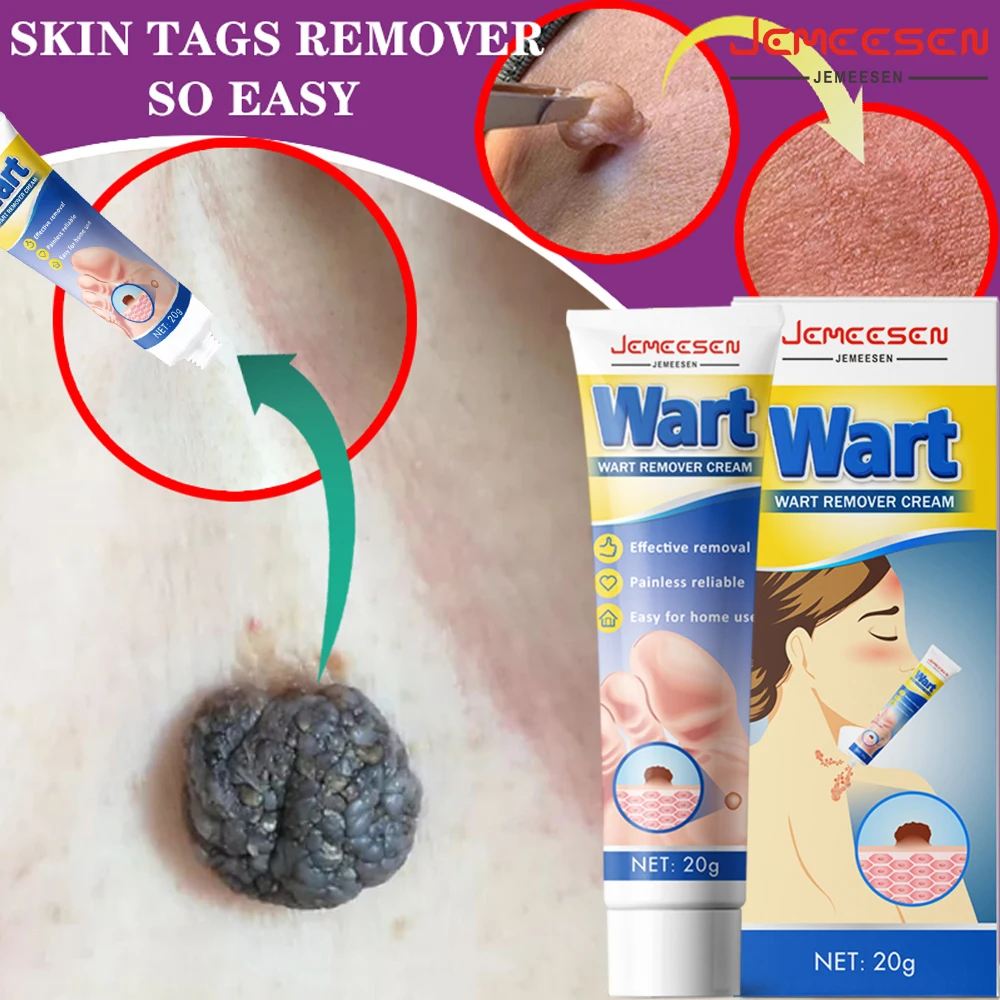 

Jemeesen Wart Spot Tag Remover Cream Painless Mole Dark Spot Warts Remover Serum Freckle Wart Treatment Removal Essential Oil