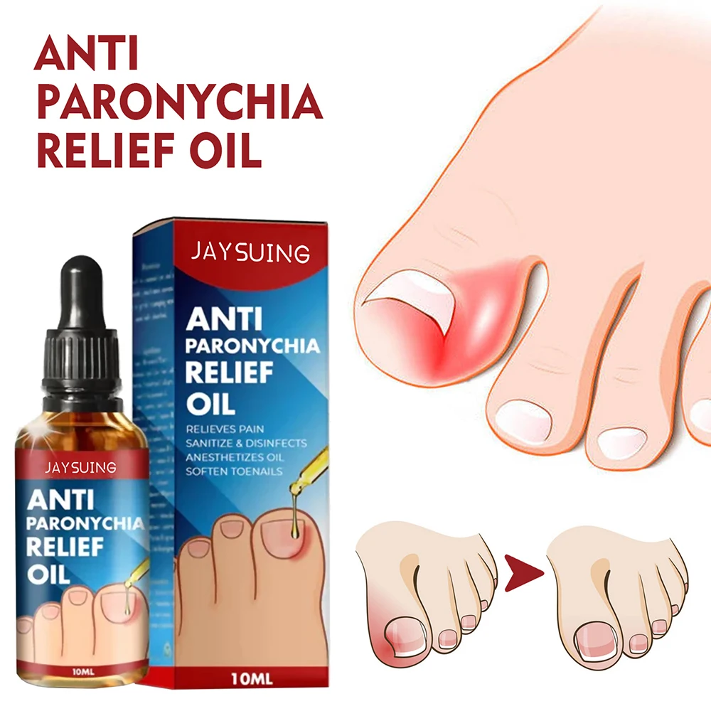 

Sdotter Anti Fungal Toe Nail Anti Paronychia Relief Oil Ingrown Toenail Drops Ingrown Corrector Stop Pain Onychomycosis Treatmen