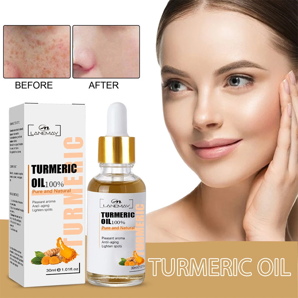 

New Turmeric Freckle Whitening Serum Fade Dark Spot Removal Pigment Melanin Correcting Facial Essence Beauty Face Skin Care 30ml