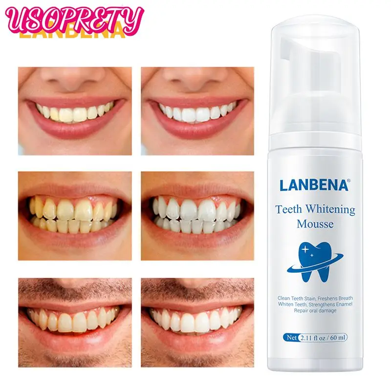 

Fresh Shining Tooth Cleaning Mousse Toothpaste TEETH WHITENING Oral Health Care Removes Plaque Stains Bad Breath 60ml TSLM1