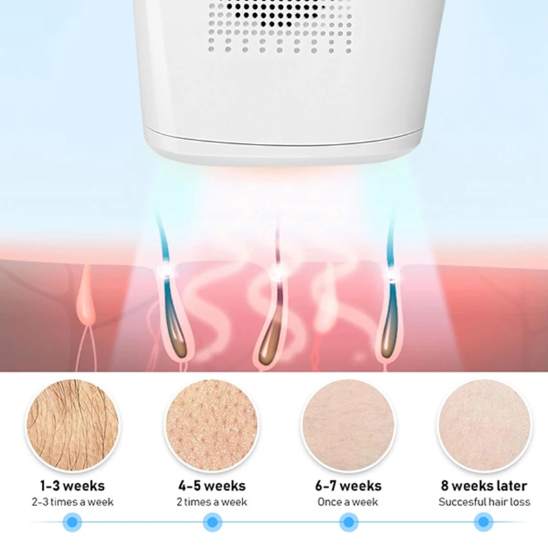 Рисунок 3 - Устройство для удаления волос MYWIN