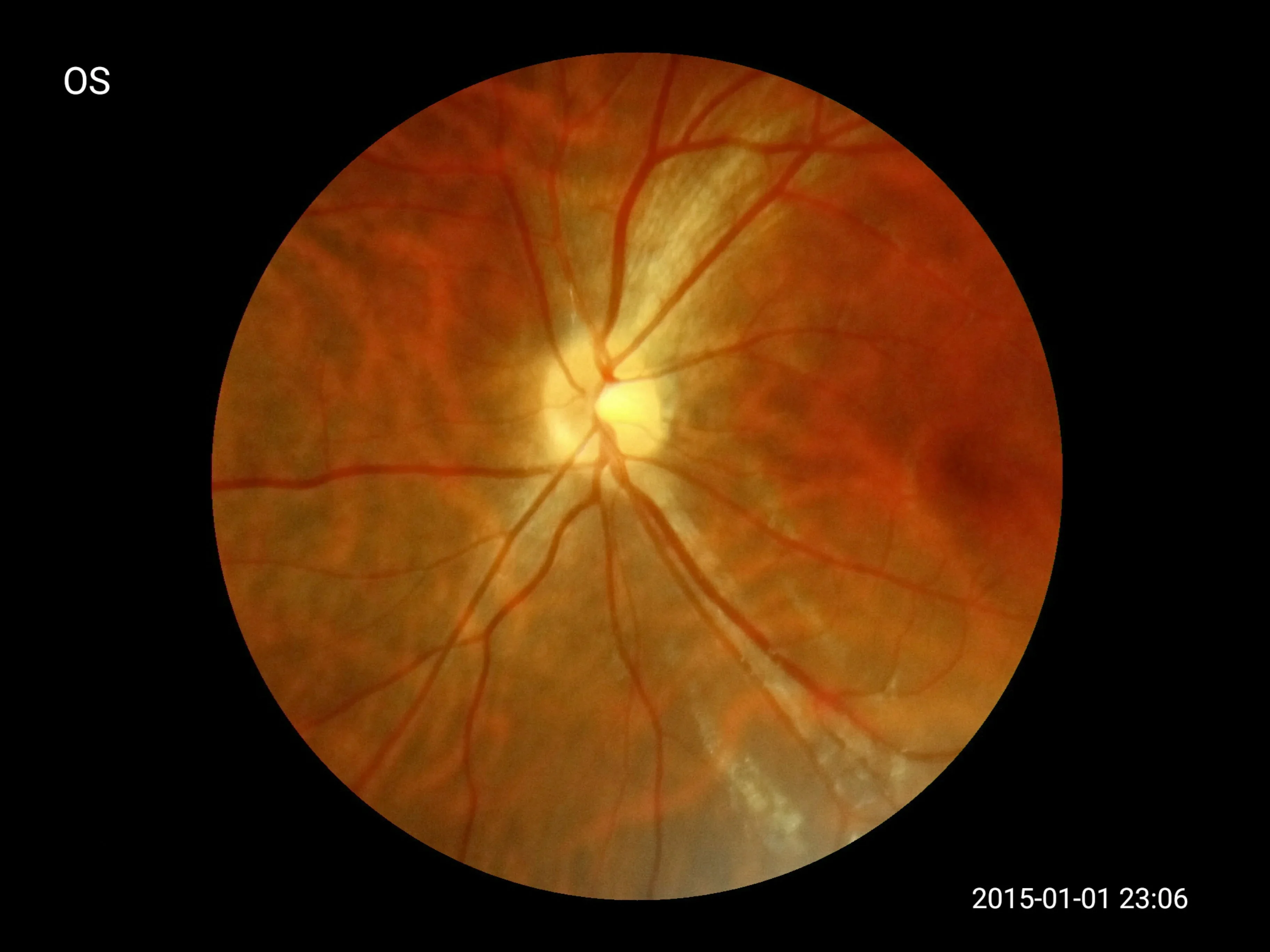 Рисунок 4 - Портативная Цифровая ручная камера