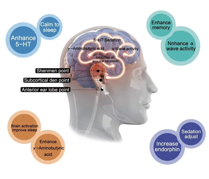 Оборудование для физиотерапии Ушной электрод стимуляции микротоков TDCS и RTMS