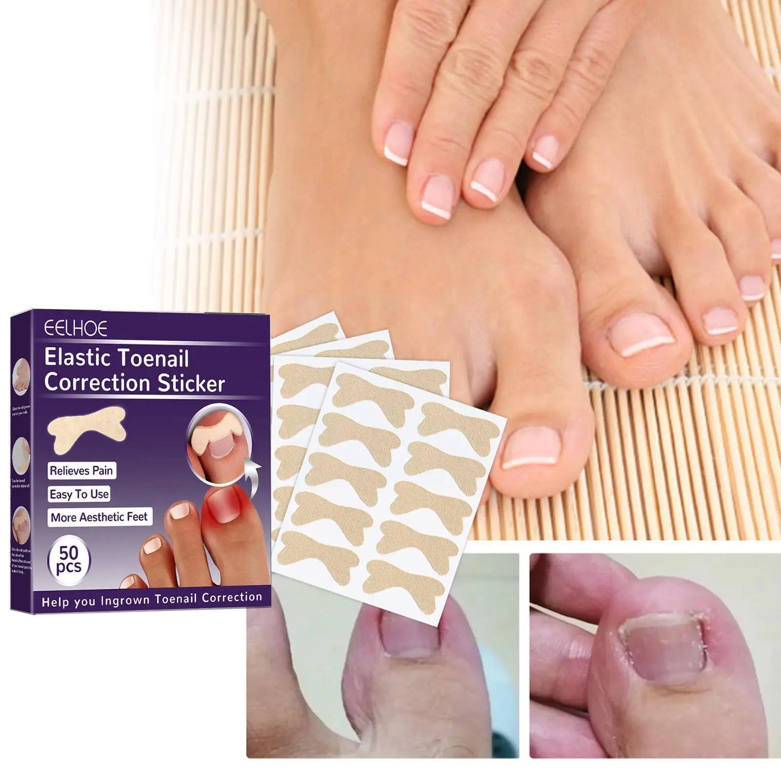 

Nail Art Ingrown Correction Sticker Foot Care Pedicure Waterproof Patch Paronychia Corrector Toenail Recover Fixer Tool M8p9