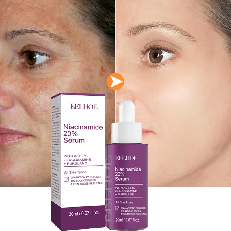 

Niacinamide Whitening Serum Spot Removal Shrink Pores Essence Anti-Aging Firming Lifting Brighten Moisturizing Facial Skin Care