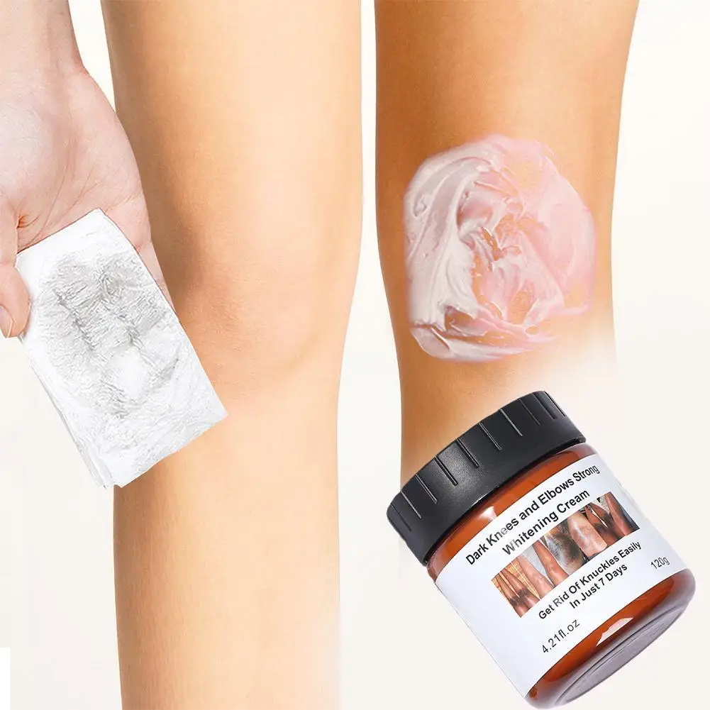 

120g Dark Feet Whitening Cream Fast Action Extreme Whitening Cream for Dark Feet Dark Knees and Elbows Strong Whitening Cre E9V8