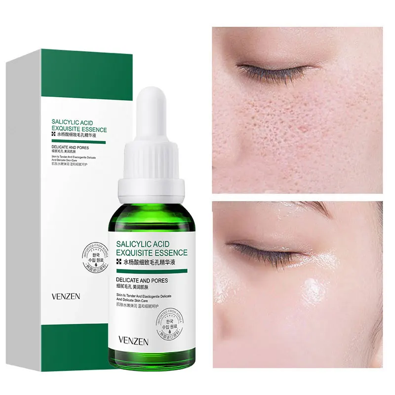 

Shrink Pores Face Serum Remove Dark Spots Improve Acne Blackheads Acid Exfoliating Moisturizing Whitening Facial Essence Skin