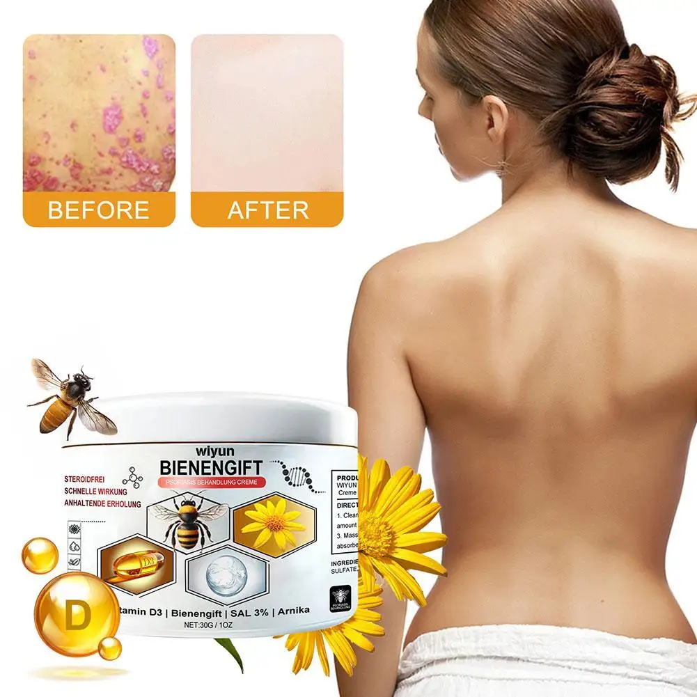 Крем для ухода за суставами и пчелиными ядами 30 г