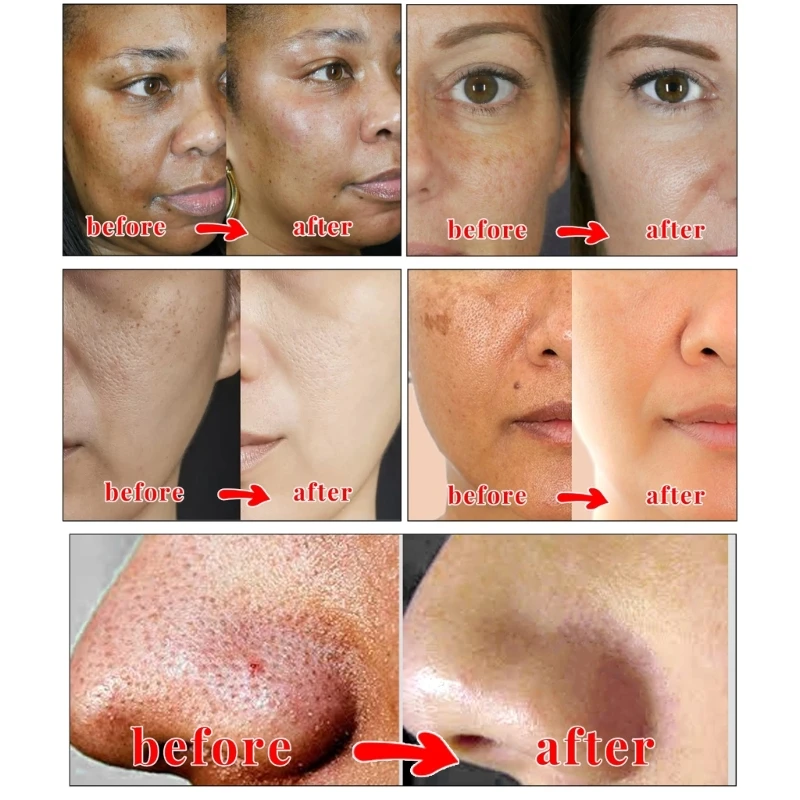 2 шт. койевая кислота мыло для лица тела ванны безопасное натуральное мужчин и