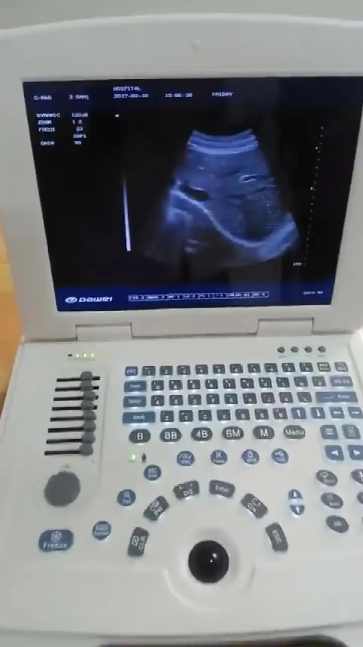 

OB/GYN Portable Handheld Ultrasound Color Doppler Medical Ultrasound Instruments