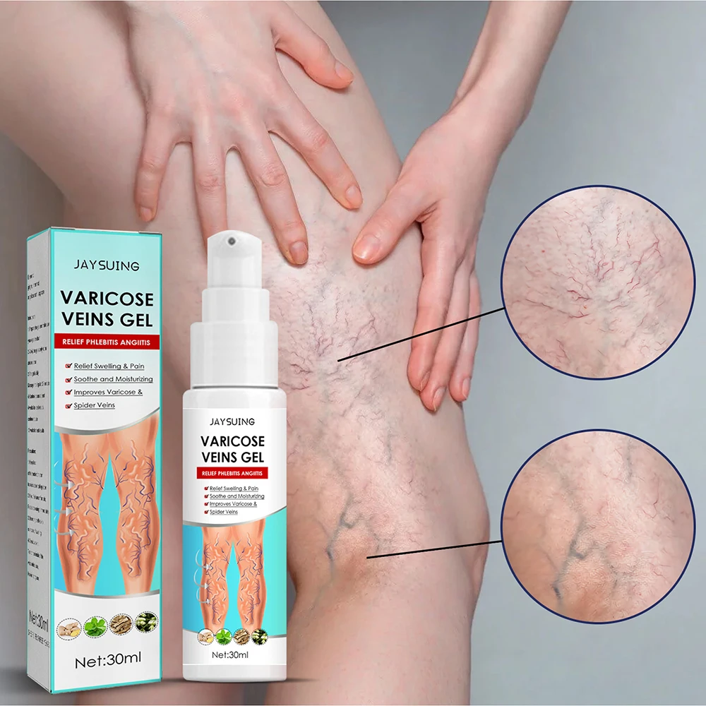 

Leg Varicose Vein Repair Gel Professional Earthworm Leg Treatment Ointment 30ml Body Skin Care Lotion Leg Care Supplies AC889