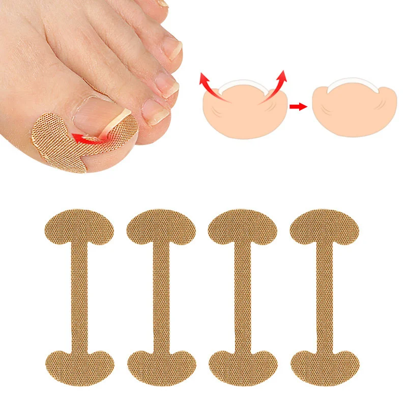 

Toenail Stickers Nail Groove Ingrown Nail Foot Nail Corrector Thumb Roll Nail Patch Fast Manicure Toenail Nail 2Pcs